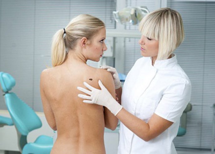 Anyajegy és bőrbetegség szűrés dermatoszkóppal