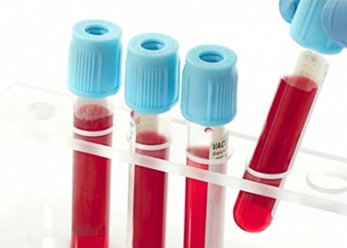 Komplett állapotfelmérés, vércsepp analízissel + candida teszttel + allergia vizsgálattal