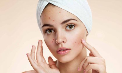 Tisztító arckezelés kamaszoknak a Beauty Deluxe Cosmetics Rózsadomb szalonban, 40-80 percben, fiúknak és lányoknak egyaránt