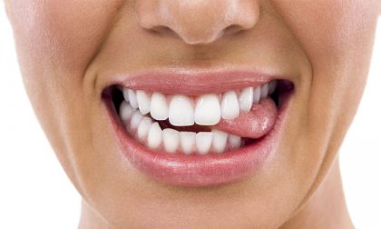Lézeres fogfehérítés a több árnyalattal fehérebb fogakért a Mosolygyár Fogászattól